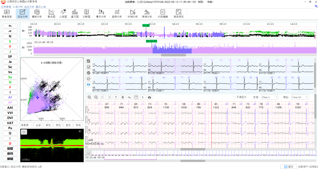 阵发性/短阵性房扑、房颤全自动分析